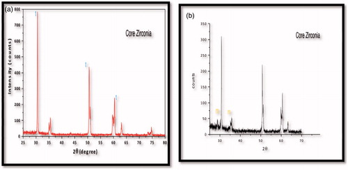 Figure 2. X-ray diffraction patterns of core zirconia: (a) before aging, (b) after aging with monoclinic (m) peaks.