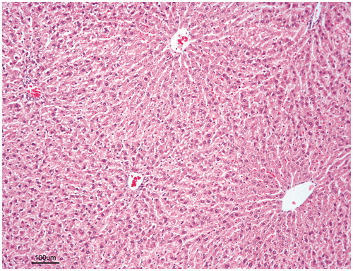 Figure 3. SW oil + CCL4-treated group: Note that there is no hydropic degeneration and coagulation necrosis in the hepatocytes and fibrosis. Haematoxylin–eosin, bar = 100 µm.