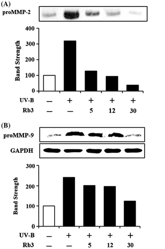 Fig. 5. Effect of Rb3 on proMMP-2 (A) protein levels in conditioned medium and proMMP-9 protein levels (B) in cellular lysate.