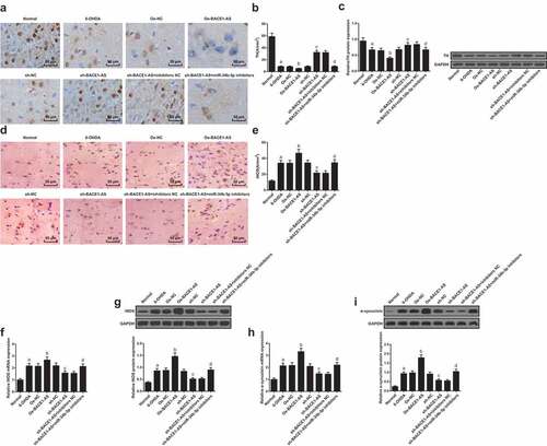 Figure 2. Downregulated BACE1-AS diminishes α-synuclein and iNOS level and increases TH level in the substantia nigra of PD rats. A. Detection of TH level in the substantia nigra of rats in each group by immunohistochemistry; B. Quantitative results of TH level of rats in each group; C. Detection of TH protein expression in the substantia nigra of rats in each group by Western blot analysis; D. Detection of iNOS level in the substantia nigra of rats in each group by immunohistochemistry. E. Quantitative results of iNOS level of rats in each group; F. Detection of iNOS mRNA expression in the substantia nigra of rats in each group by RT-qPCR; G: Detection of iNOS protein expression in the substantia nigra of rats in each group by Western blot analysis; H: Detection of α-synuclein mRNA expression in the substantia nigra of rats in each group by RT-qPCR; I: Detection of α-synuclein protein expression in the substantia nigra of rats in each group by Western blot analysis; the data in the figure were all measurement data expressed as mean ± standard deviation; a, P < 0.05 vs the normal group; b, P < 0.05 vs the oe-NC group; c, P < 0.05 vs the sh-NC group; d, P < 0.05 vs the sh-BACE1-AS+inhibitors NC group