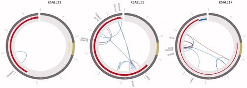 Figure 2. Circos plot of chromosome 21 with intrachromosomal rearrangements detected by mate-pair WGS in three iAMP21 samples. Blue links represent rearrangements retaining the original strand orientation, red links represent inverted rearrangements. Copy number changes are shown with red (amplifications) and blue (deletions) lines in the circos edges.