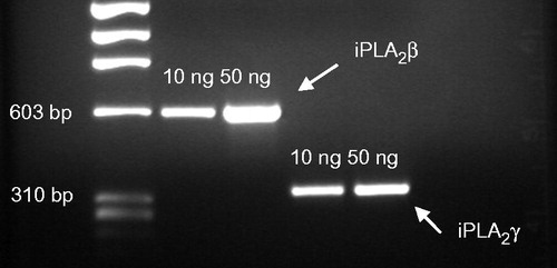 Figure 1. RT-PCR of iPLA2γ and iPLA2ß in murine MC3T3-E1 osteoblast-like cells. Cells were cultured in α-MEM, RNA was isolated and iPLA2γ and iPLA2ß fragments were amplified by RT-PCR using specific forward and reverse oligonucleotide primer pairs. The PCR products were separated on 1.5% agarose gels. Expected amplicone sizes were 589 bp for iPLA2ß und 332 bp for iPLA2γ. One representative experiment out of three is shown.