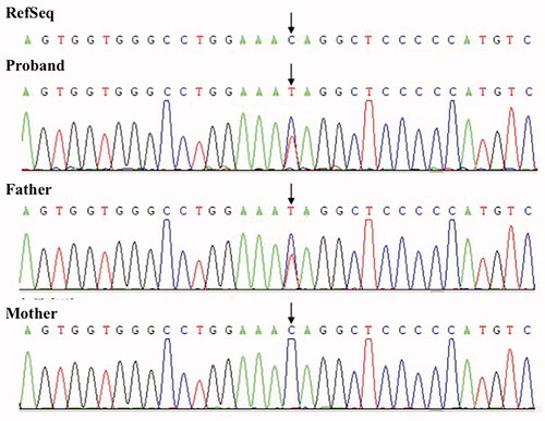Figure 1. Sanger sequencing the results of the proband and her parents. RefSeq: National Centre for Biotechnology Information Reference Sequences.