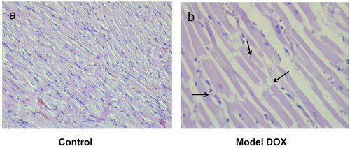 Figure 4. Photomicrographs of muscle sections of left ventricular chambers stained with H&E × 400. (a) Control (group 1) - normal myofibrilar architecture. (b) DOX-treated animals (group 8; cumulative dose: 20 mg/kg, b.w., i.p.) - disorganization of cardiac muscle fibres (left arrow), cytoplasmic fading and pyknotic nucleus formation (central arrow) and myofibril ruptures (right arrow).