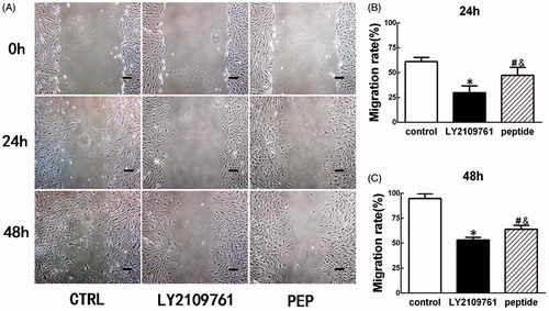 Figure 4. TGF-β peptide antagonist inhibited migration of HS fibroblasts. In vitro scratch wound assay was employed to measure cell migration rate, which was semi-quantified with Image pro-plus version 6.0 (Media Cybernetics, Silver Spring, MD). (A) Gross view of scratched and migrated areas at 24 h and 48 h for the cells treated with peptide antagonist (PEB, 30 μM) or TGF-β type I/II receptor kinase inhibitor (LY2109761, 10 μM) or without treatment (CTRL). (B) Semi-quantification of migration rate at 24 h post-wounding. (C) Semi-quantification of migration rate at 48 h post-wounding. *p < 0.05 between control and LY2109761 groups; #p < 0.05 between control and peptide groups; &p < 0.05 between LY2109761 and peptide groups.