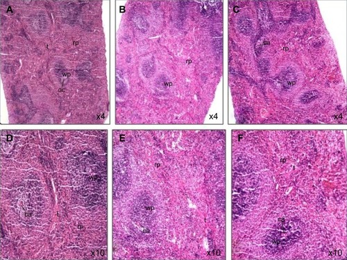 Figure 6 Photomicrograph of spleen tissue sections of rats treated with Ni nanoparticles.Notes: (A and D) Show normal spleen morphology with 1 mg/kg of Ni nanoparticles (X40 and X100, respectively); (B and E) show increased red pulp area with 10 mg/kg of Ni nanoparticles (X40 and X100, respectively); (C and F) show increased red pulp area with 20 mg/kg of Ni nanoparticles (X40 and X100, respectively).Abbreviations: ca, central artery; gc, germinal center; Ni, nickel; rp, red pulp; t, trabeculae; wp, white pulp.
