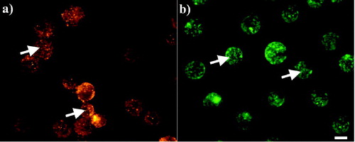 Figure 4.  Distribution of (a) Cx43 and (b) F-actin in non-sonicated chondrocytes 1 h after their preparation. Cx43 (a) appeared highly granulated at the cytoplasm of the cells (arrows), while F-actin (b) consisted of an intricate network (arrows). Scale bar is 10 µm.