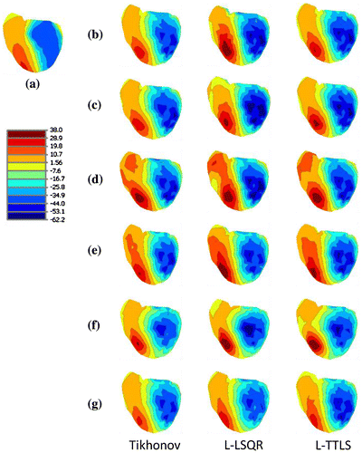 Figure 5. MAP3D results at t = 53 ms for Tikhonov regularization, L-LSQR, and L-TTLS methods. Panel (a) show true epicardial potential distribution. The remaining panels (in groups of 3 images) correspond to solutions with (b) 771 complete lead-set, (c) 192 lead-set, (d) 64 lead-set-I, (e) 64 lead-set-II, (f) 32 lead-set-I, and (g) 32 lead-set-II.