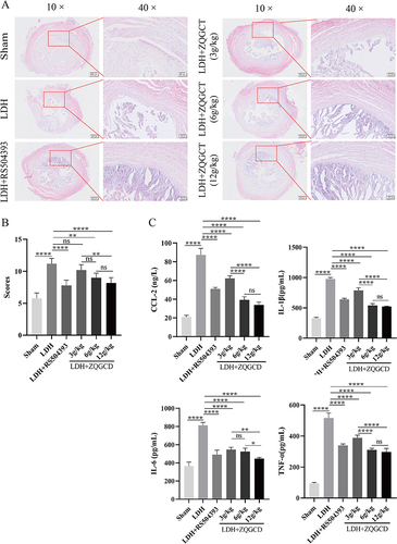 Figure 7 CCR2 inhibitor or ZQGCD improved intervertebral disc degeneration and inhibited serum inflammatory cytokines expression in LDH rats. (A) Representative HE-stained intervertebral disc sections (magnification: 10× or 40×). (B) Intervertebral disc histopathologic score. (C) Comparison of serum inflammatory cytokines CCL2, IL-1β, IL-6, and TNF-α. *P<0.05, **P<0.01, ****P<0.0001, ns: P>0.05.