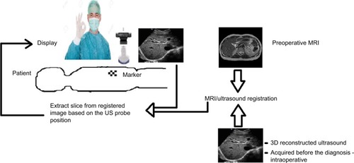 Figure 5 Concept of combining MRI images directly with US inside the MRI suite.