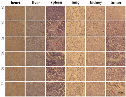 Figure 11. Histological images of tumors and major organs after different preparation processing. (a) Saline, (b) free Cur, (c) free Cur/Bai, (d) QHMF@Cur, (e) QH@Cur/Bai, and (f) QHMF@Cur/Bai.