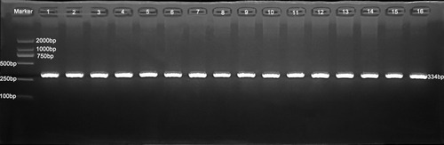 Figure 1 Agarose gel electrophoresis for PCR products of different genotypes of the omentin-1 gene (334 bp). Val/Asp: Lane 1, 3–6, 9, 12, 13, 16; Val/Val: Lane 10, 11; Asp/Asp: Lane 2, 7, 8, 14, 15.