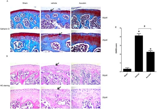 Figure 1 Oral administration of aucubin preserved articular cartilage. (A) Safranin O staining. Solid arrows show proteoglycan loss and cartilage destruction at 8-week post operation. Scale bar, 50 μM (top), 25 μM (bottom). (B) H&E staining where hyaline cartilage (HC) thickness is declined and marked by arrows. Scale bars, 50 μM (top), 25μM (bottom). (C) OARSI scores of articular cartilage at 8-week post operation. Sham: sham-surgery; Vehicle: DMM-surgery treated with vehicle; Aucubin: DMM-surgery treated with aucubin. n=6 per group. Significant differences analysis in all groups compared with the sham group (*P<0.05), compared with the vehicle group (#P<0.05).