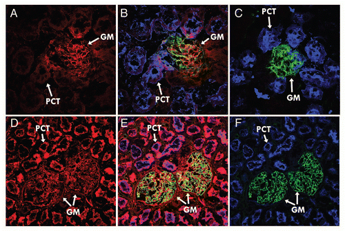 Figure 3 Immunofluorescent detection of hFcRn (red channel) in kidney tissue sections from (A) hFcRn transgenic mice, (B) hFcRn transgenic mice costained for proximal convoluted tubule (blue channel) and podocytes (green channel), (C) wild-type B6 mice costained for proximal convoluted tubule and podocytes, (D) human tissue, (E) human tissue costained for proximal convoluted tubule and podocytes, and (F) human tissue showing only proximal convoluted tubule and podocytes (GM, Glomerulus, PCT, proximal convoluted tubules).