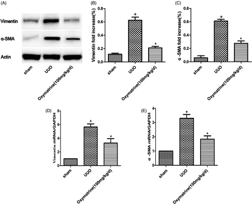 Figure 2. OMT suppresses activation of myofibroblasts in obstructed kidneys. (A) Western blot analysis for vimentin and α-SMA in different treatment groups. (B, C) Statistical analysis of relative expression of vimentin and α-SMA. (D, E) mRNA levels of vimentin and α-SMA in the different treated groups. +p < 0.01 versus sham group. *p < 0.05 versus UUO with vehicle-treated group.