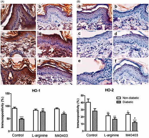 Figure 6. Immunohistochemical staining for HO1 (A) and HO2 (B) in the skin of non-diabetic control (a), diabetic untreated (b), non-diabetic L-arginine-treated (c), diabetic L-arginine-treated (d), non-diabetic M40403-treated (e) and diabetic M40403-treated (f) rats. Data obtained after quantitative evaluation of immunohistochemistry images represent the mean ± SEM. *Comparison with non-diabetic untreated control, *p < .05; **p < .01; ***p < .001. #Comparison with diabetic untreated control, #p < .05; ##p < .01. Magnification: 40× orig.; insets 63×. HO1: heme oxygenase 1; HO2: heme oxygenase 2.