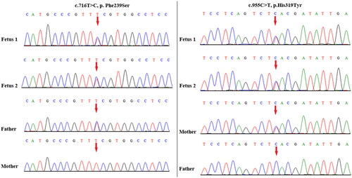 Figure 2. Variant confirmation by Sanger sequencing. Compound heterozygous variants c.716T > C and c.955C > T in TOE1 were detected in both fetuses and their asymptomatic parents. The red arrow indicates the variant site.