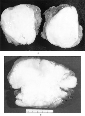 Figure 2 (a) Macrosection of the biceps muscle mass. (b) Macrosection of the trapezius muscle mass.