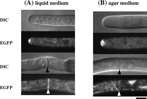 Fig. 4. Localization of α-amylase fused with EGFP in liquid and agar cultures.Citation16).