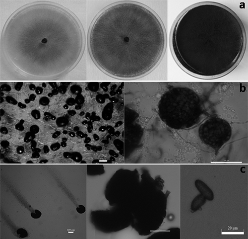 Fig. 2 a, Fungal colony of M. phaseolina isolates grown on PDA after 5 days (left), 10 days (middle), 21 days (right). b, Microsclerotia immersed in agar surface. c, Pycnidia (left), protruding conidia from pycnidia (middle), conidia (right).