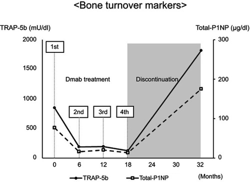 Figure 1 Bone turnover marker (TRAP-5b, total-P1NP) levels. TRAP-5b and total-P1NP levels increased immediately following discontinuation of denosumab.