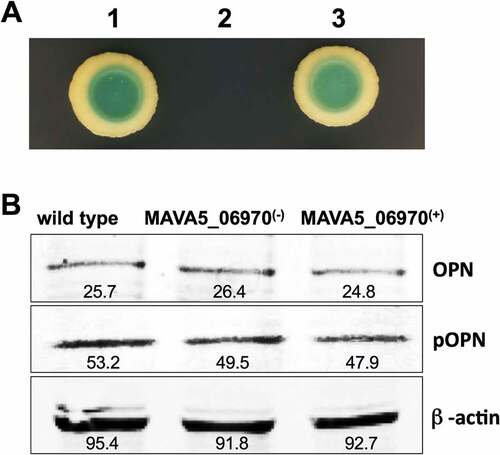 Figure 5. (A) The yeast two-hybrid interaction of MAVA5_06970 with the host target SPP1 protein. The open reading frame of SPP1 encoding a 301 amino acid protein was amplified from the cDNA of THP-1 cells amplified from the total RNA. The yeast two-hybrid screening of MAVA5_06970 established positive interaction with SPP1 (1). The known interaction between pGBKT7-lam and pGADT7-T served as a positive control (3), and pGBKT7-53 and pGADT7-T as a control for a negative interaction (2). (B) OPN levels of secondary THP-1 cells infected with the wild type M. avium, the gene knockout MAVA5_06970(-) mutant and complemented MAVA5_06970(+) clone. After 2h of infection cell lysates were subjected to OPN immunoprecipitation under denaturing conditions by using an agarose-conjugated primary antibody and analyzed via anti-OPN antibody (a) or phosphoserine/threonine/tyrosine antibody (b). The photon emission means were recorded for each band to quantify the signal intensity on the Odyssey Imager (Li-Cor). The β–actin served as a loading control (c).
