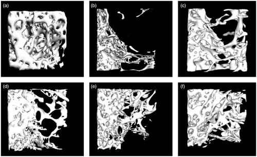 Figure 2. Representative Micro-CT images of trabecular bone microarchitecture in the distal femurs. (a) SHAM group, (b) OVX group, (c) E2 group, (d) DZW-L group, (e) DZW-M group and (f) DZW-H group. The OVX rats presented notable reduction in the trabecular number, trabecular area compared with the SHAM rats. DZW and E2 partially prevented OVX-induced trabecular bone loss and significantly improved trabecular bone mass and microarchitecture.