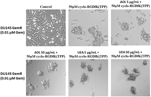 Figure 8 Phase-contrast images of DU145 GemR MCTS formation on day 5 with cyclo-RGDfK(TPP) peptide and pretreatment with AOL and UEA-1 lectins. Phase-contrast images of DU145 GemR cells pretreated with AOL or UEA-1 lectin at concentrations of 5 µg/mL and 50 µg/mL,for 1 hr followed with 50 µM cyclo-RGDfK(TPP). 10,000 cells were plated per well in a 96-well plate for 5 days. The images are representative of two fields of view in two independent experiments. The images are taken at a magnification of 100×.