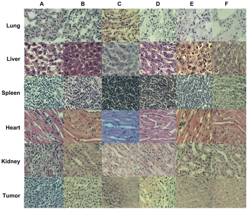 Figure 12 Histologic assessments of major organs and tumor tissues with hematoxylin and eosin staining in mice (200×). (A) NS, (B) SWNT, (C) SWNT-DTX, (D) DTX, (E) SWNT-NGR-DTX, and (F) SWNT-NGR-DTX-laser.Abbreviations: SWNT, single-walled carbon nanotubes; NGR, (Asn-Gly-Arg) peptide; DTX, docetaxel; NS, normal saline.