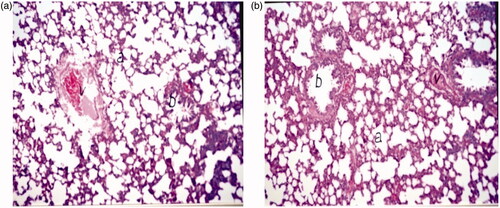 Figure 6. Light photomicrograph of rat lung 24 h post-IV administration of (a) D5W and (b) formula F8 at a magnification of ×160 (a: air alveoli, b: bronchiol and v: blood vessel).