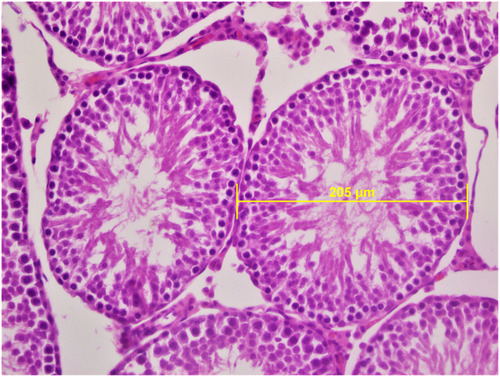 Figure 2 In ketamine group spermatozoa were not observed, only spermatids were seen in the seminiferous tubules. Seminiferous tubule diameters were measured in transverse tubules (H&E×400).