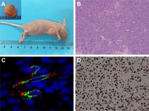 Figure 7 (A) MCF-7 orthotopic breast tumor nude mice model; (B) the H&E staining of tumor tissue (magnification: ×100); (C) merged confocal microscopic images of MCF-7 orthotopic breast tumor tissue after immunofluorescence staining of VEGFR2 (green), which overlap well with CD31-staining of vascular endothelial cells (red); (D) the IHC images of p53 protein (brown granules; magnification: ×400).Abbreviations: CD-31, cluster of differentiation 31; IHC, immunohistochemistry; VEGFR2, vascular endothelial growth factor receptor type 2.