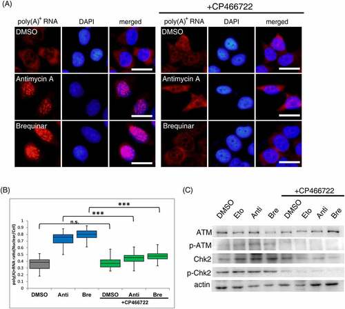 Figure 3. ATM activation is required to elicit nuclear accumulation of poly(A)+ RNA by inhibitors of the respiratory chain complex III and DHODH.