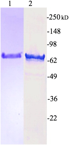 Figure 1. Recombinant Cry1Ab. Lane 1, Cry1Ab stained with Coomassie brilliant blue. Lane 2, recognition of Cry1Ab polyclonal rabbit anti-Cry1Ab IgG. Molecular weight markers are indicated as kilodalton.