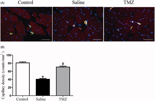 Figure 2. TMZ therapy promotes angiogenesis in the ischaemic hindlimb of diabetic mice. (A) Sections of ischaemic muscles recovered at day 14 post-surgery were stained for CD31 (endothelial stain; red), α-SMA (smooth muscle strain; green), and DAPI (nuclear stain; blue). Representative immunofluorescence of muscle sections were shown (n = 3 sections per mouse, 10 mice per group). Scale bar: 50 μm; (B) Quantitative analysis of capillary density in gastrocnemius muscle was performed. Results are expressed as mean ± SEM. *p < .05 compared to the control group, #p < .05 compared to the saline group.