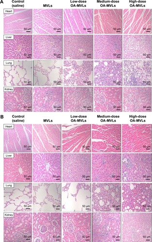 Figure 7 H&E results of histopathological sections of the heart, liver, lung, and kidney from Sprague Dawley rats treated every other day for 30 days with blank MVLs, low-dose OA-MVLs (25 mg/kg), medium-dose OA-MVLs (50 mg/kg), and high-dose OA-MVLs (100 mg/kg), respectively, taking saline as control.Notes: (A) All organs were obtained within 48 hours after the last treatment. (B) All organs were obtained on day 14 after the last treatment for restorative observation.Abbreviations: H&E, hematoxylin and eosin; MVLs, multivesicular liposomes; OA-MVLs, oleanolic acid-encapsulated multivesicular liposomes.