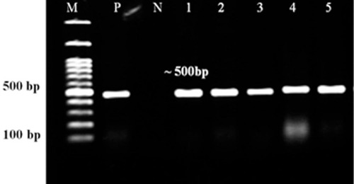 Figure 2 PCR assay of azurin gene. Lanes 1–5: P. aeruginosa isolates, Lanes N and P: representatives of negative and positive controls. M: 100 bp DNA size marker.