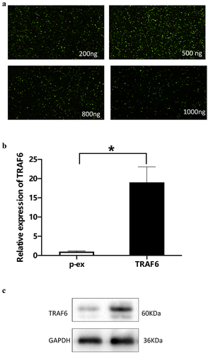 Figure 2. Verification of concentration of TRAF6 vector. a: 500 ng vector of TRAF6 was detected as an optimum concentration by immunofluorescence. b: Transfection efficacy was detected by qRT-PCR. c: Transfection efficacy was detected by Western blot. A t-test was used to compare p-ex and TRAF6. Data are expressed as mean ± SD referred to the control (*p<0.05) P-EX: blank vector; TRAF6: vector of overexpression of TRAF6.