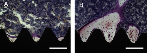 Figure 11 Histological sections with Villanueva staining showing bone tissue morphology around the implant (black).Notes: (A) TNS surface, and (B) TNS-MAP surface; bar =200 μm (***P<0.001; **P<0.01).Abbreviations: TNS, titanium with nanonetwork structures; TNS-MAP, titanium with nanonetwork structures coated with mussel adhesive protein.