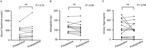 Figure 1. The hemoglobin levels, serum creatinine levels and urinary NAGL levels before and after the operation. The mean preoperative and postoperative hemoglobin of patients were 113.4 ± 24.1 g/L and 108.0 ± 27.9 g/L, respectively (B). The median preoperative and postoperative serum creatinine of patients were 304.2 (141.1, 569.7) μmol/L and 325.0 (171.6, 549.5) μmol/L, respectively (A). The median preoperative and postoperative urinary NAGL were 213.6 (52, 391.8) ng/ml and 192.1 (60.0, 325.0) ng/ml, respectively (C).