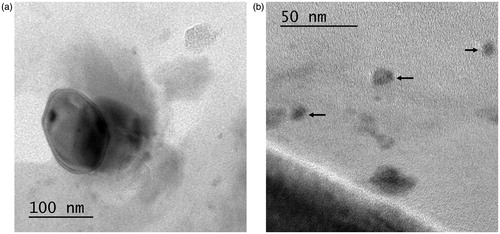 Figure 6. HR-TEM photomicrographs of ROPI-DS nanoplex (1.5:1) at 100 nm (a), 50 nm (b) (120,000× magnification).