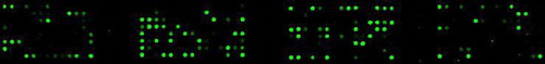 Figure 1.  Microarray (HOMIM) illustrating the bacterial profile of a subgingival plaque sample.