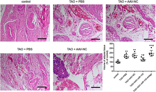 Figure 6 Role of miR-143 in the pathogenesis of thyroid-associated ophthalmopathy (TAO) using an in vivo model. Representative images of HE staining in mouse orbital tissue. The volume of adipose tissue was quantified. n = 6 per group. *P < 0.05, **P < 0.01 compared to the control group. #P < 0.05 compared to the TAO+PBS group.