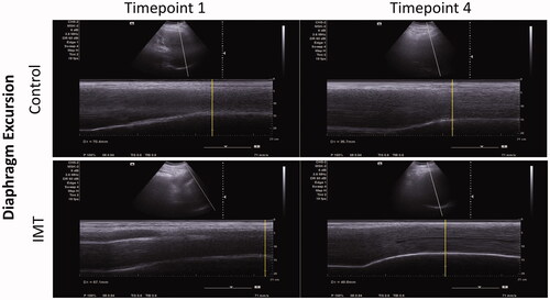 Figure 3. The M-mode images of diaphragmatic excursion in the CTL group and the IMT group at Timepoint 1 and Timepoint 4.