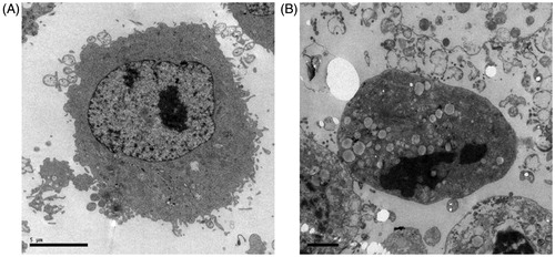 Figure 3. Ultrastructure imaging of SGC-7901 cells. TEM illustrates the effect of apoptosis on SGC-7901 cells: (A) was untreated; (B) was treated with TTF from C. nudicaule for 48 h at 8 μg/mL. Apoptotic cells exhibited decreased microvilli, minished cytoplasm with increased electron density and physalides, and evident karyopyknosis in nucleolus.