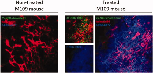 Figure 3. In vivo tumor distribution in the M109 model after inhalation of coated fluorescent folate-grafted copolymer nanocarriers. Confocal images of control untreated M109 mouse lung and coated fluorescent folate-grafted copolymer nanocarriers-treated mouse lung. Green: 25-NBD-cholesterol labeling SLN; red: vessels labeled with isolectinB4; blue: Alexa Fluor 405 labeling the coating. Reproduced with permission from (Rosiere et al., Citation2018). Copyright (2018) American Chemical Society.