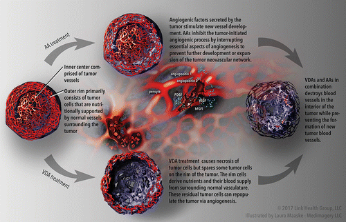 Figure 1. Solid tumor undergoing treatment with combined vascular targeted therapies (VTT). The top portion of the figure illustrates anti-angiogenic agent (AA)-induced inhibition of tumor progression. The lower portion of the figure illustrates vascular disrupting agent (VDA)-induced necrosis of the central tumor cells (with a peripheral rim of viable tumor cells spared). The right-hand side of the figure illustrates the complementary effects of VDAs and AAs in combination (combined VTT): the destruction of blood vessels in the interior of the tumor and the prevention of new tumor vasculature formation, which together have negative effects on the tumor's growth and survival. ©2017 Link Health Group, LLC; Illustrated by Laura Maaske, Medimagery LLC.