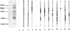 Figure 2 Western blot analysis of autoantibodies against mesangial cell in sera of patients with lupus nephritis (2). Lane 1: blank control; Lane 2: normal control; Lanes 3 to 5: sera from three patients with lupus nephritis recognized a 74 kD band; Lane 6: sera from a patients with lupus nephritis recognized 63 and 24 kD bands; Lane 7: sera from a patients with lupus nephritis recognized a 63 kD band; Lane 8: sera from a patients with lupus nephritis recognized 63, 52 and 46 kD bands; Lane 9: sera from a patients with lupus nephritis recognized 63, 52 and 36 kD bands; Lane 10: sera from a patients with lupus nephritis recognized 63, 36, 24 and 18 kD bands; Lane 11: sera from a patients with lupus nephritis recognized a 63 kD band; Lane 12: sera from a patients with lupus nephritis recognized 52, 24 and 18 kD bands; Lane 13: sera from a patients with lupus nephritis recognized 36 and 18 kD band.