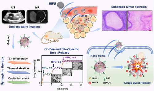 Figure 5 Schematic illustration of nano-bomb with site-specific drug burst release to achieve HIFU/chemotherapy synergistic therapy under the US/MR-guided imaging. Reprinted from Journal of Controlled Release. Mai X, Chang Y, You Y et al. Designing intelligent nano-bomb with on-demand site-specific drug burst release to synergize with high-intensity focused ultrasound cancer ablation, pages 270–281. Copyright 2020, with permission from Elsevier.Citation66