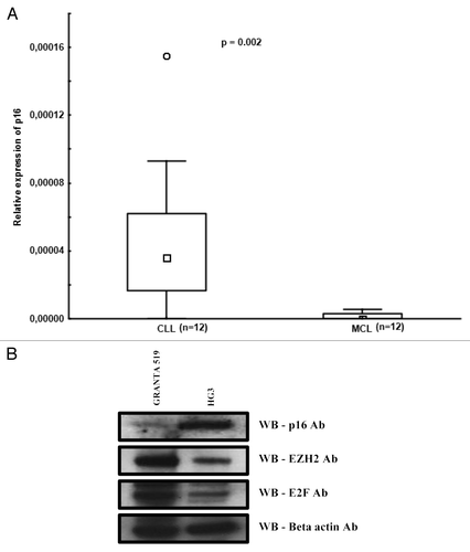 Figure 4. Differential expression of p16 in CLL and MCL. (A) Box plots showing relative p16 expression levels in CLL and MCL primary samples quantified using RQ-PCR. (B) Western blot analysis of p16, EZH2, E2F, and β actin in the HG3 and Granta 519 cell line.